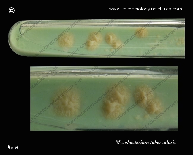 L�wenstein-Jensen medium in a tube